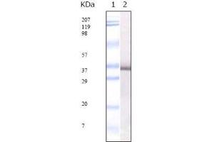 Western Blot showing SARS-E2GP3 antibody used against SARS-E2GP3 recombinant protein. (SARS-CoV E2 Glycoprotein anticorps)