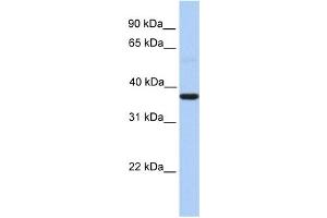 WB Suggested Anti-ZC3H15 Antibody Titration:  0. (ZC3H15 anticorps  (Middle Region))