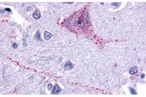 Anti-TACR3 antibody  ABIN1049391 IHC staining of human brain, neurons and glia. (TACR3 anticorps  (N-Term))