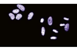 Immunofluorescent staining of HeLa cells.