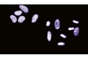 Immunofluorescent staining of HeLa cells. (SSB anticorps  (AA 179-289))