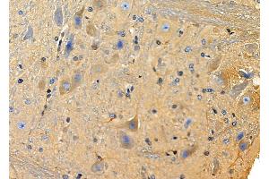 ABIN6258650 and ABIN6275381 at 1/100 staining Rat brain tissue by IHC-P.