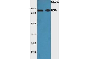 L1 mouse brain lysate L2 mouse heart lysates probed with Anti Phospho-ATG1(Ser556)Polyclonal Antibody, Unconjugated  at 1:3000 for 90 min at 37˚C. (ULK1 anticorps  (pSer556))
