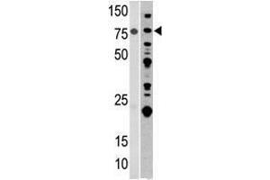 Image no. 1 for anti-Aconitase 2, Mitochondrial (ACO2) (Center) antibody (ABIN357262) (ACO2 anticorps  (Center))