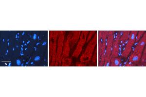 Rabbit Anti-XBP1 Antibody   Formalin Fixed Paraffin Embedded Tissue: Human heart Tissue Observed Staining: Cytoplasmic Primary Antibody Concentration: 1:100 Other Working Concentrations: 1:600 Secondary Antibody: Donkey anti-Rabbit-Cy3 Secondary Antibody Concentration: 1:200 Magnification: 20X Exposure Time: 0.