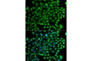 Immunofluorescence analysis of A549 cells using ZFYVE1 antibody (ABIN5975594).