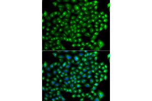 Immunofluorescence analysis of A549 cells using ZFYVE1 antibody (ABIN5975594). (ZFYVE1 anticorps)