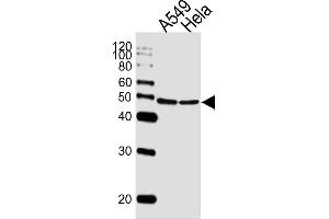 Lane 1: A549 lysates, Lane 2:HeLa lysates, probed with CBX8 (1214CT171. (CBX8 anticorps)