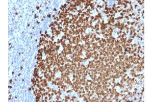 Formalin-fixed, paraffin-embedded human Tonsil stained with Ki67 Mouse Monoclonal Antibody (MKI67/2461). (Ki-67 anticorps  (AA 2293-2478))