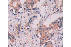 Used in DAB staining on fromalin fixed paraffin- embedded breast tissue (MYH11 anticorps  (AA 162-315))