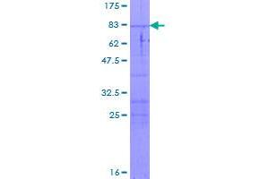 Image no. 1 for Bleomycin Hydrolase (BLMH) (AA 1-455) protein (GST tag) (ABIN1346715)
