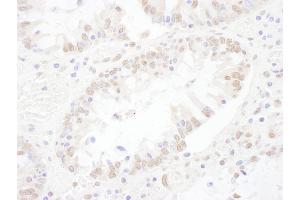 Immunohistochemistry (IHC) image for anti-Small Nuclear Ribonucleoprotein 200kDa (U5) (SNRNP200) (AA 1-50) antibody (ABIN7453645)