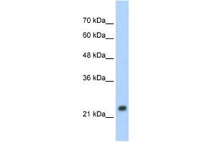 WB Suggested Anti-HSPB1 Antibody Titration: 1. (HSP27 anticorps  (C-Term))