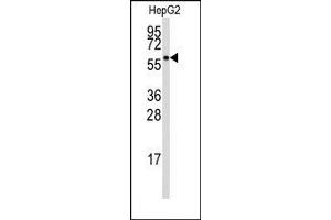 Image no. 1 for anti-Aldehyde Dehydrogenase 3 Family, Member B1 (ALDH3B1) (Middle Region) antibody (ABIN360240) (ALDH3B1 anticorps  (Middle Region))