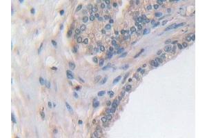 Detection of UTRN in Human Prostate Tissue using Polyclonal Antibody to Utrophin (UTRN)