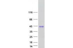 Validation with Western Blot