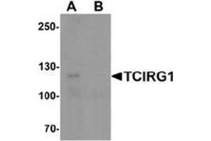 Western blot analysis of TCIRG1 in EL4 cell lysate with TCIRG1 Antibody  at 0. (TCIRG1 anticorps  (N-Term))
