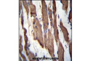 TGFBR Antibody (C-term) 3395b immunohistochemistry analysis in formalin fixed and paraffin embedded human skeletal muscle followed by peroxidase conjugation of the secondary antibody and DAB staining. (TGFBRAP1 anticorps  (C-Term))