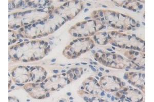 Detection of BRD8 in Mouse Small intestine Tissue using Polyclonal Antibody to Bromodomain Containing Protein 8 (BRD8)