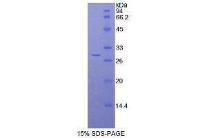 SDS-PAGE analysis of Human Titin Protein. (Titin Protein (TTN))