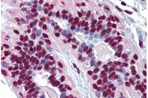 Human Breast: Formalin-Fixed, Paraffin-Embedded (FFPE)