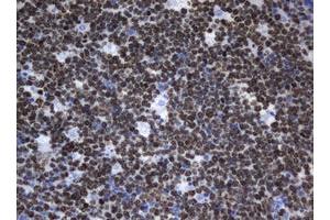 Image no. 3 for anti-Antigen Identified By Monoclonal Antibody Ki-67 (MKI67) (AA 1160-1493) antibody (ABIN1490856) (Ki-67 anticorps  (AA 1160-1493))