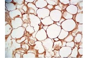 Rat visceral fat tissue was stained by Rabbit Anti-Cathepsin S (298-331) (Human) Serum (Cathepsin S anticorps  (AA 298-331))