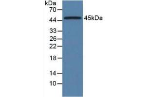 Western blot analysis of Rat Pancreas Tissue. (ORM1 anticorps  (AA 19-186))