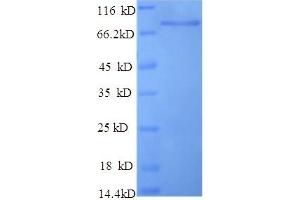 SDS-PAGE (SDS) image for Keratin 10 (KRT10) (AA 1-584), (full length) protein (His tag) (ABIN5709823)