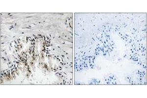 Immunohistochemistry analysis of paraffin-embedded human prostate carcinoma tissue, using RPL31 Antibody. (RPL31 anticorps  (AA 61-110))