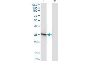 Western Blot analysis of RAB32 expression in transfected 293T cell line by RAB32 monoclonal antibody (M01), clone 1C7. (RAB32 anticorps  (AA 136-225))