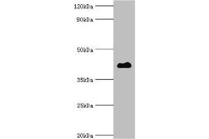 Western blot Western blot All lanes: Histone deacetylase 8 antibody at 2 μg/mL + Hela whole cell lysate Secondary Goat polyclonal to rabbit IgG at 1/10000 dilution Predicted band size: 42, 30, 18, 32, 29, 16, 17 kDa Observed band size: 42 kDa (HDAC8 anticorps  (AA 1-377))
