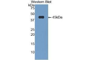 Detection of Recombinant GFAP, Mouse using Polyclonal Antibody to Glial Fibrillary Acidic Protein (GFAP)