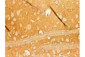 ABIN6265408 and ABIN6268871 at 1/100 staining Rat lung tissue by IHC-P. (beta Synuclein anticorps  (C-Term))