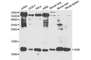 Western blot analysis of extracts of various cell lines, using B2M antibody. (beta-2 Microglobulin anticorps  (AA 21-119))