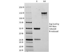 SDS-PAGE Analysis of Purified, BSA-Free NCAM Antibody (clone 123C3.