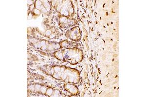 Immunohistochemistry of paraffin embedded rat colon using NAIF1 (ABIN7074867) at dilution of 1:2500 (400x lens) (NAIF1 anticorps)