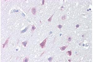 Anti-NPC1 antibody IHC staining of human brain, cortex. (NPC1 anticorps  (C-Term))