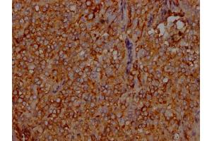 IHC image of ABIN7127599 diluted at 1:100 and staining in paraffin-embedded human adrenal gland tissue performed on a Leica BondTM system. (Recombinant LDLR anticorps)