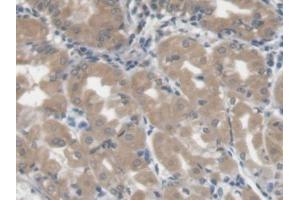 DAB staining on IHC-P; Samples: Human Stomach Tissue) (LGALS3BP anticorps  (AA 24-221))