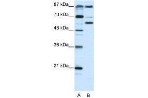 WB Suggested Anti-PCAF Antibody Titration:  2. (KAT2B anticorps  (N-Term))