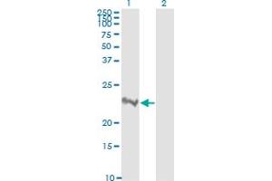 Western Blot analysis of RHOA expression in transfected 293T cell line by RHOA monoclonal antibody (M04), clone 1B12.