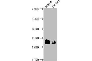 Western Blot Positive WB detected in: MCF-7 whole cell lysate, Jurkat whole cell lysate All lanes: MGMT antibody at 1:1500 Secondary Goat polyclonal to rabbit IgG at 1/50000 dilution Predicted band size: 22 kDa Observed band size: 22 kDa (Recombinant MGMT anticorps)