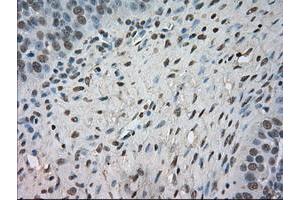 Image no. 6 for anti-Neurotrophic tyrosine Kinase, Receptor, Type 3 (NTRK3) antibody (ABIN1499842)