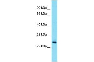 Host: Rabbit Target Name: TEX36 Sample Type: Fetal Brain lysates Antibody Dilution: 1. (TEX36 anticorps  (Middle Region))