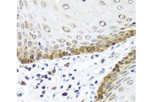 Immunohistochemistry of paraffin-embedded Human esophagus using BMP5 Polyclonal Antibody at dilution of 1:100 (40x lens).