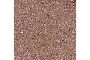 IHC analysis of NSF using anti-NSF antibody (ABIN7601630).