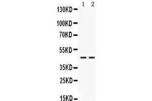 Western blot analysis of Cathepsin K expression in HELA whole cell lysates (lane 1) and 22RV1 whole cell lysates (lane 2). (Cathepsin K anticorps  (AA 115-329))