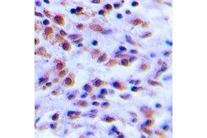 anti-S100 Calcium Binding Protein A12 (S100A12) antibody