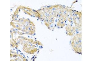 Immunohistochemistry of paraffin-embedded Mouse heart using GPLD1 Polyclonal Antibody at dilution of 1:100 (40x lens). (GPLD1 anticorps)